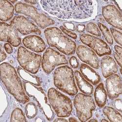 Puromycin-sensitive aminopeptidase/NPEPPS Antibody, Novus Biologicals:Antibodies:Primary